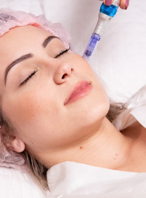 woman receiving microneedling rejuvenation treatment