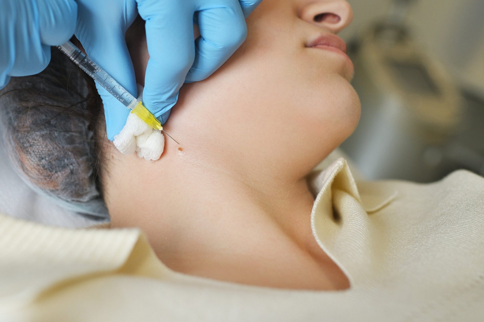 surgeon performs anesthesia before removing a mole or nevus to a female patient in a modern clinic